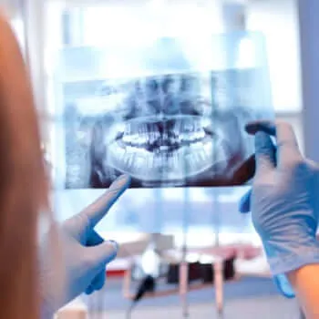 Tooth extractions and fillings at our dental office in Roanoke, VA