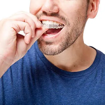 Invisalign clear aligners offered by our dentist in Roanoke, VA