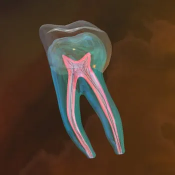 Root canal treatment at our dental clinic in Roanoke, VA