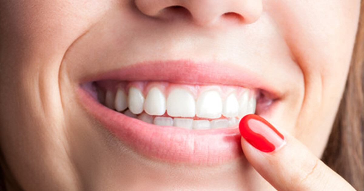 Deep Teeth Cleaning in Roanoke: Cost & Recovery